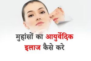 18 Best Ayurvedic Treatment for Pimples in Hindi