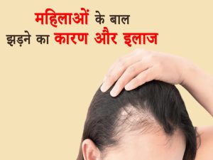 25 Best Hair Loss Treatment for Women in Hindi