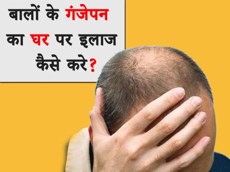 9 Best Hair Baldness Treatment at Home in Hindi