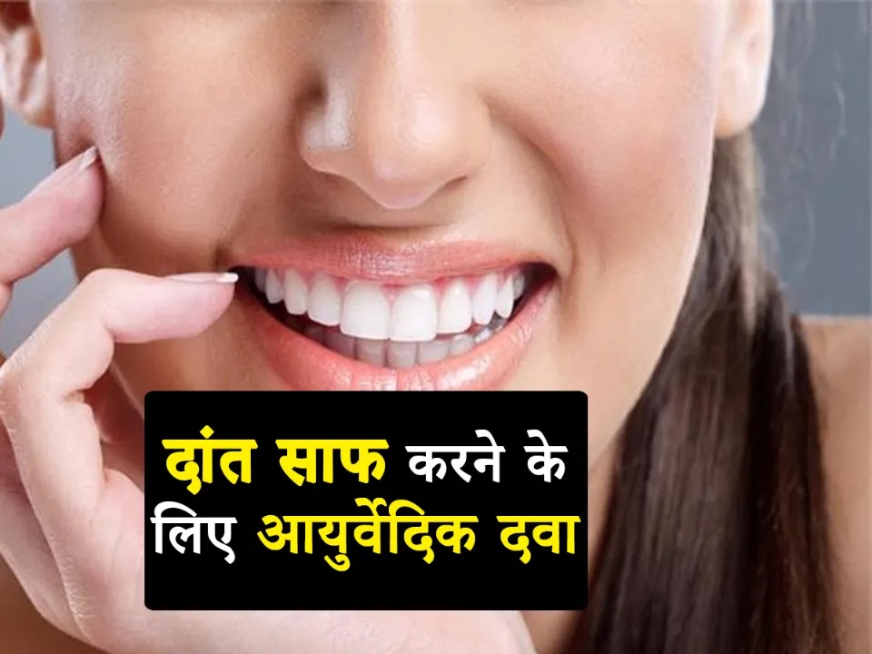 Ayurvedic Teeth Whitening Powder in Hindi
