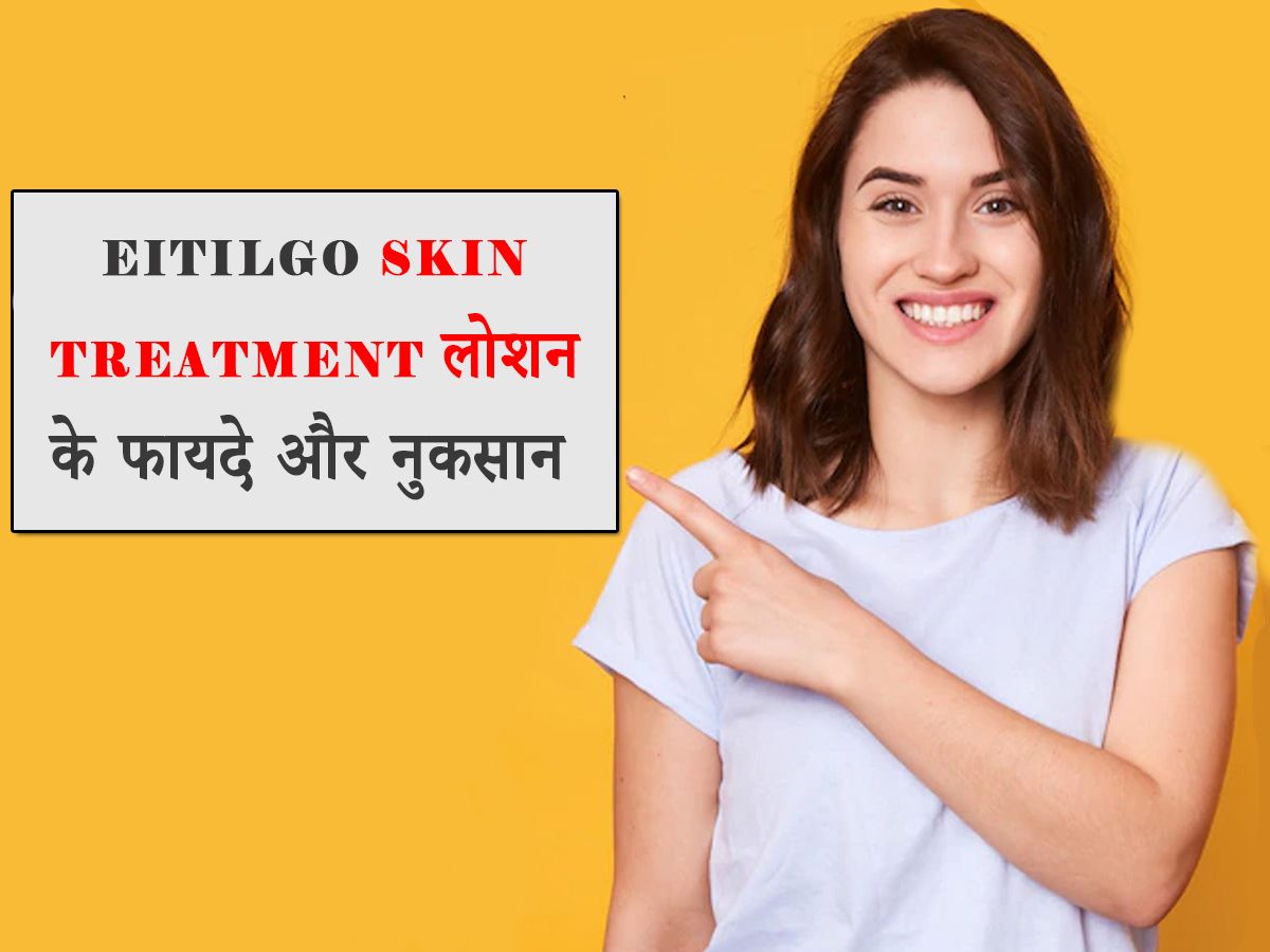 Eitilgo Skin Treatment Lotion Uses in Hindi