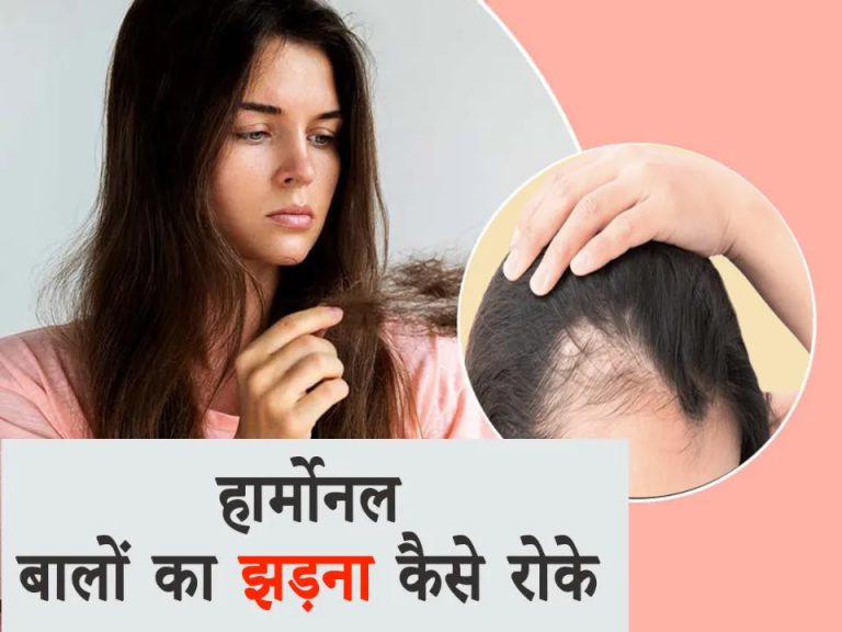 How to Stop Hormonal Hair Loss in Hindi