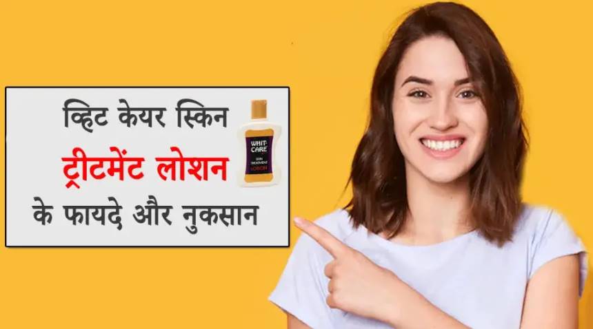 Whit Care Skin Treatment Lotion Uses in Hindi