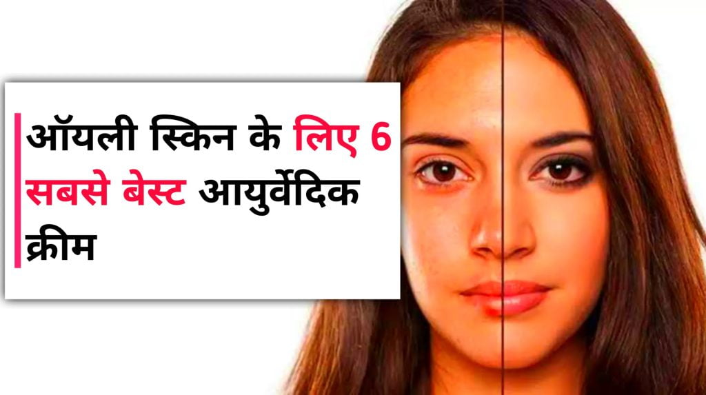 ऑयली स्किन के लिए 6 सबसे बेस्ट आयुर्वेदिक क्रीम Oily Skin Ke Liye Ayurvedic Cream in Hindi gudji