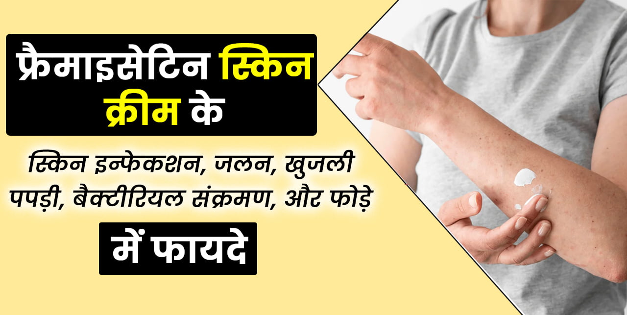 Framycetin Cream Ke Fayde aur Nuksan फ़्रेमाइसेटिन क्रीम के फायदे और